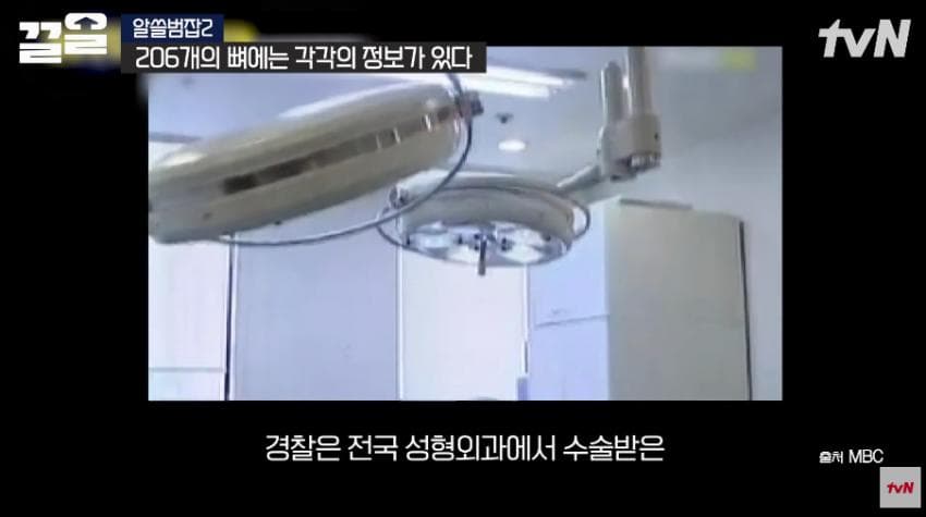 안면윤곽술을 받아야 하는 이유