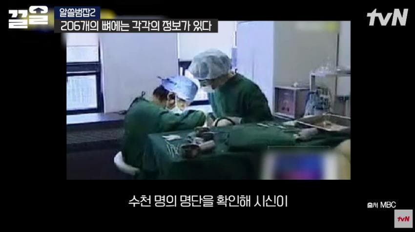 안면윤곽술을 받아야 하는 이유