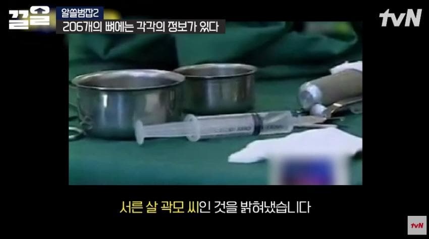 안면윤곽술을 받아야 하는 이유