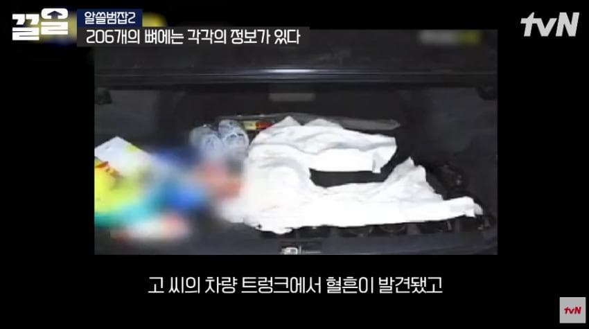 안면윤곽술을 받아야 하는 이유