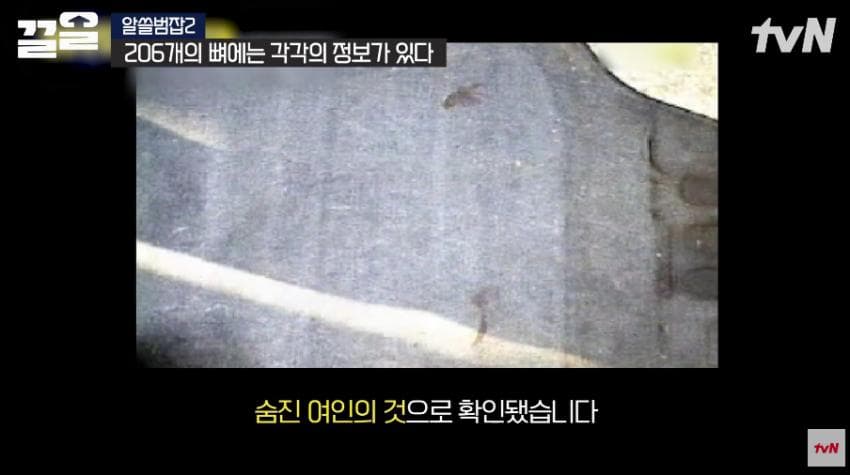 안면윤곽술을 받아야 하는 이유