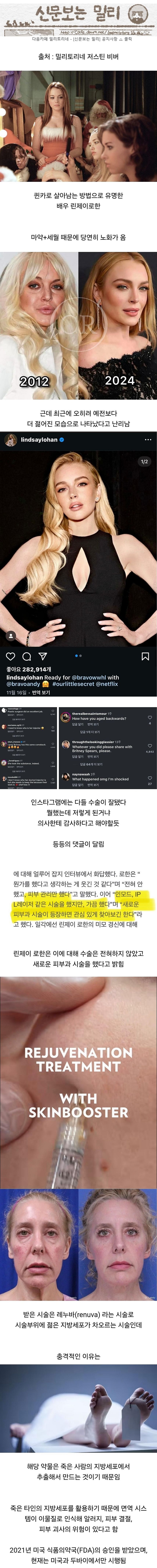 최근 헐리우드에서 난리난 젊어지는 시술