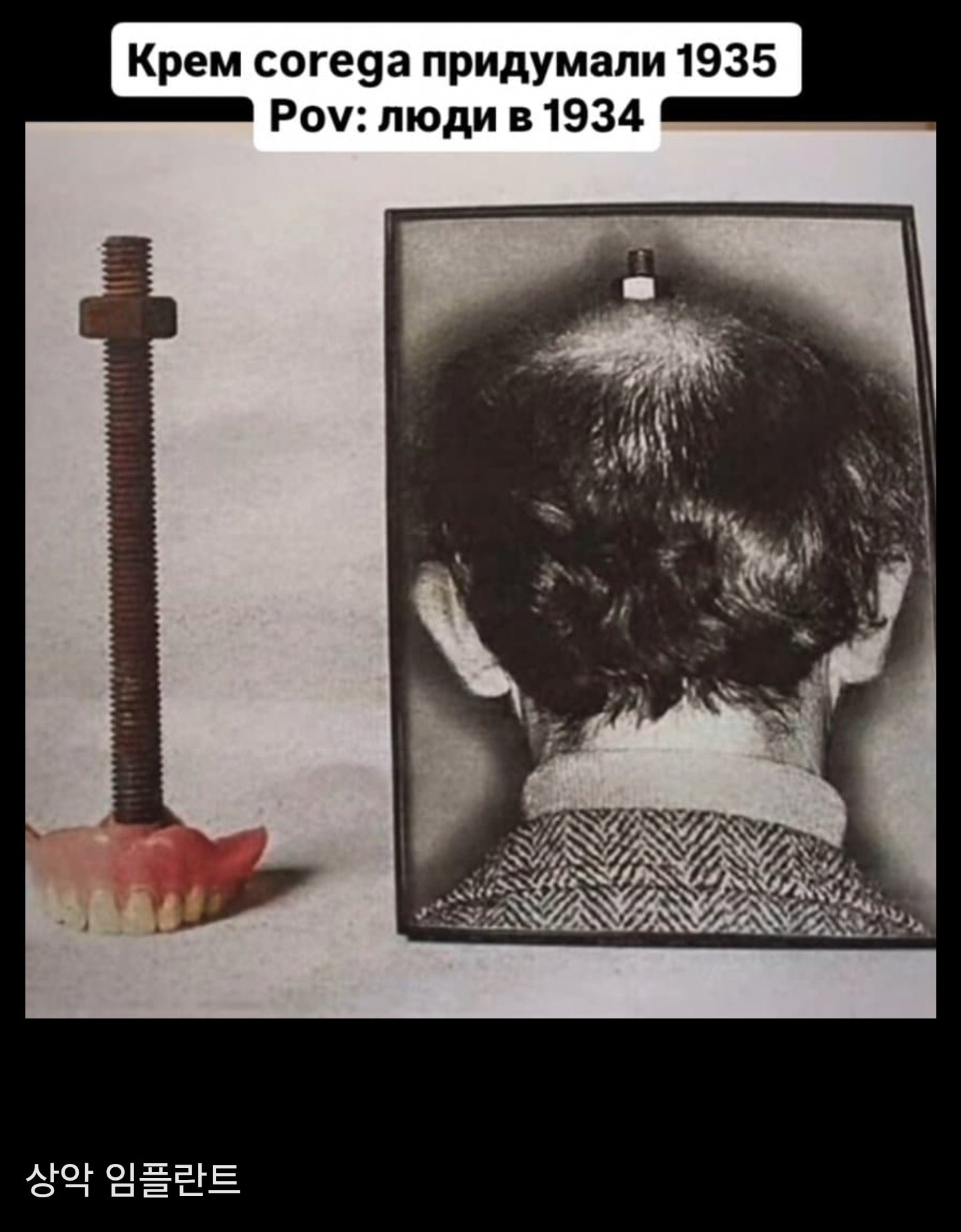 와들와들 1930년대 외과수술 수준