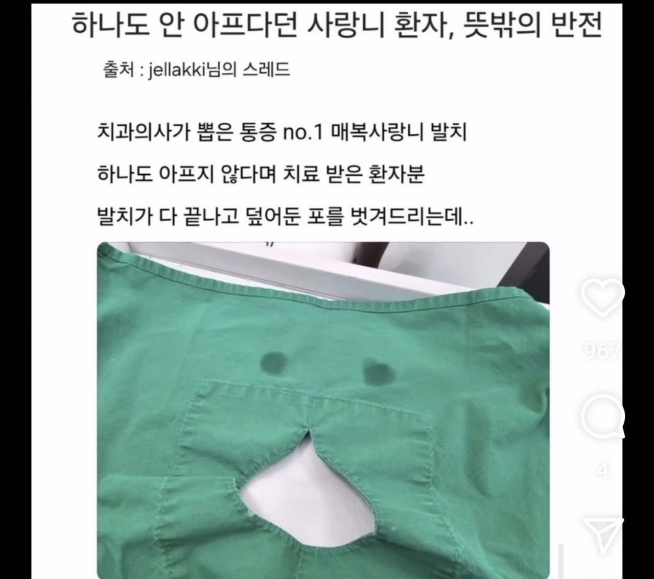 사랑니 뽑는데 안 아프다던 손님