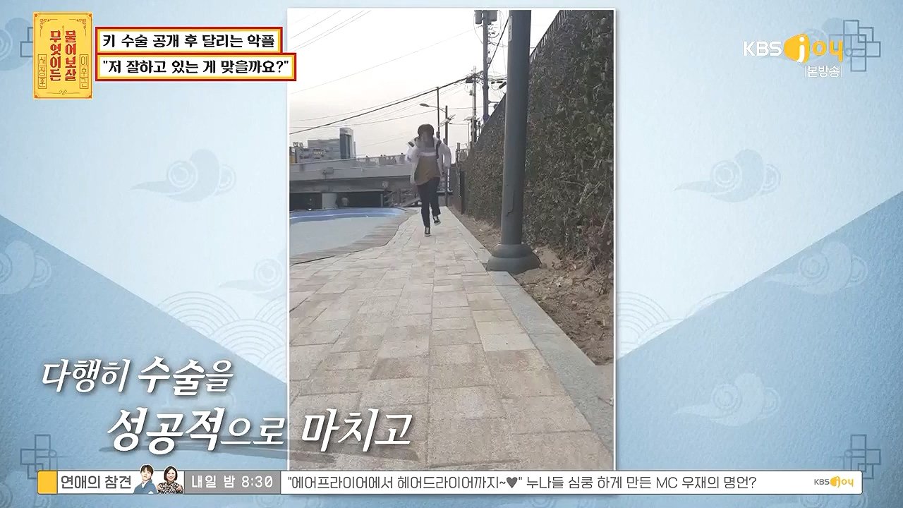 키 크는 수술 성공한 사람 .jpg