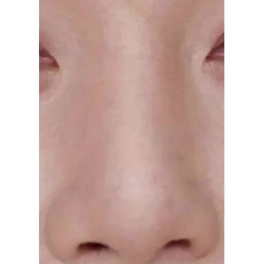 눈,코,입이 예뻐도 안 예쁠 수 있음