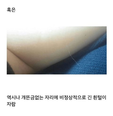 쌩뚱맞은 부위에 생기는 털