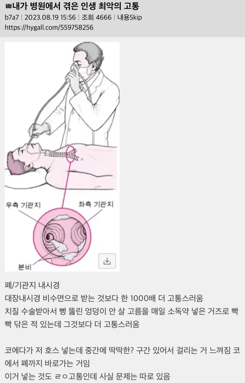 내가 병원에서 겪은 인생 최악의 고통