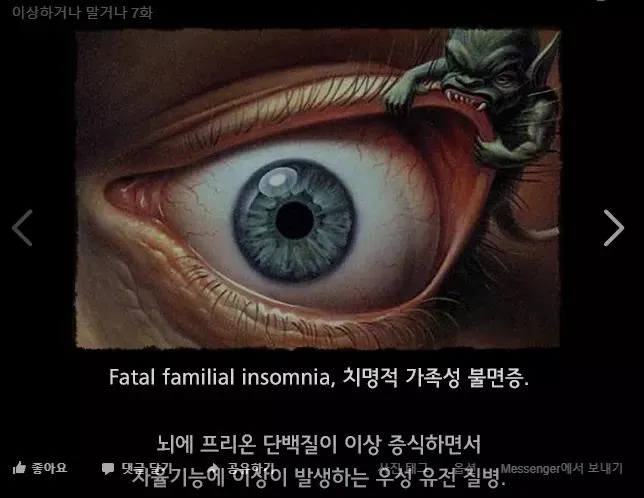한번 발병하면 죽을때까지 잠을 잘 수 없는 병