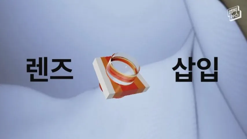 눈에 치아를 넣어 시력을 회복하는 수술