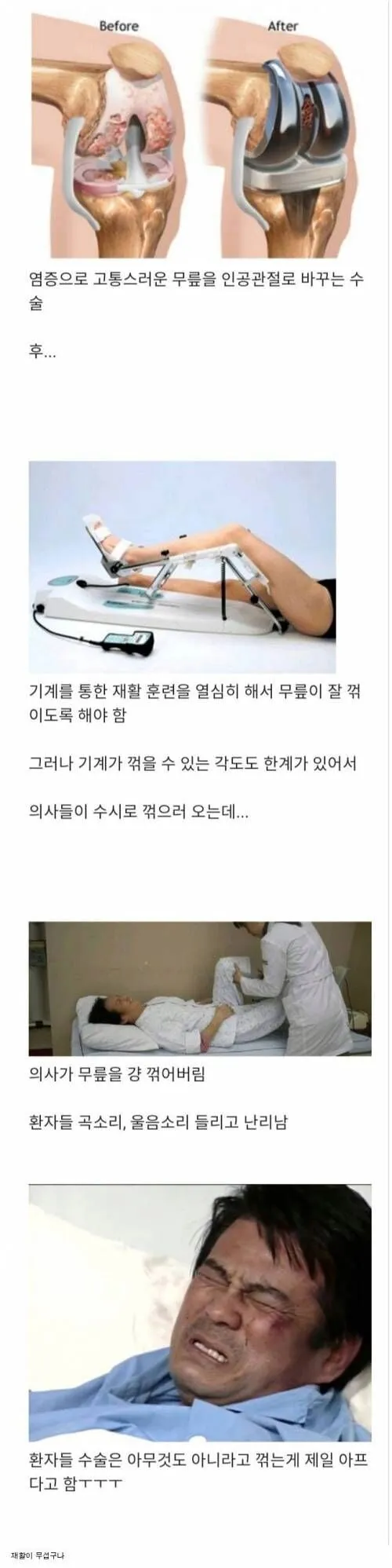 인공관절 수술 후, 환자들 최고의 고통