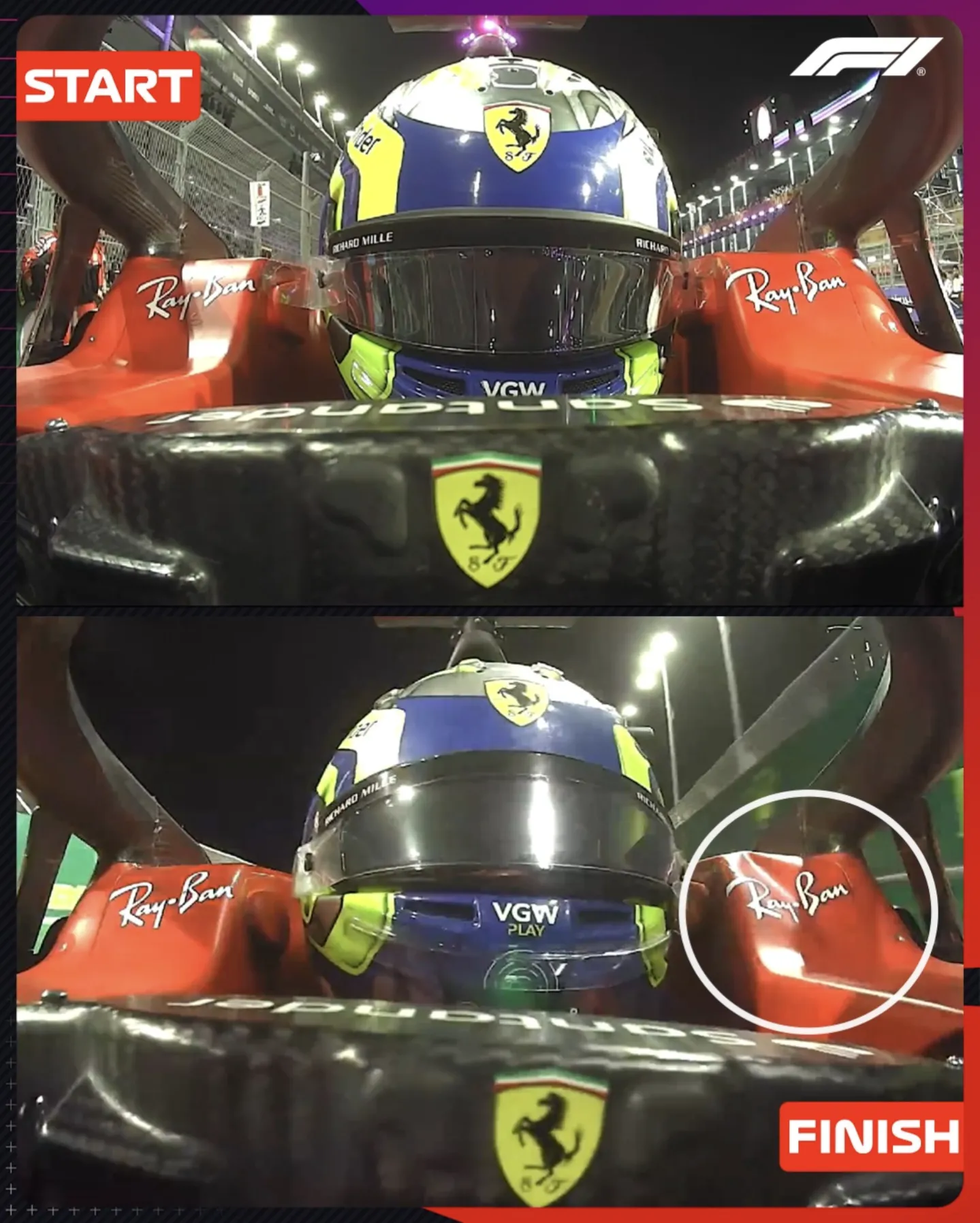F1드라이버에게 목운동이 중요한 이유