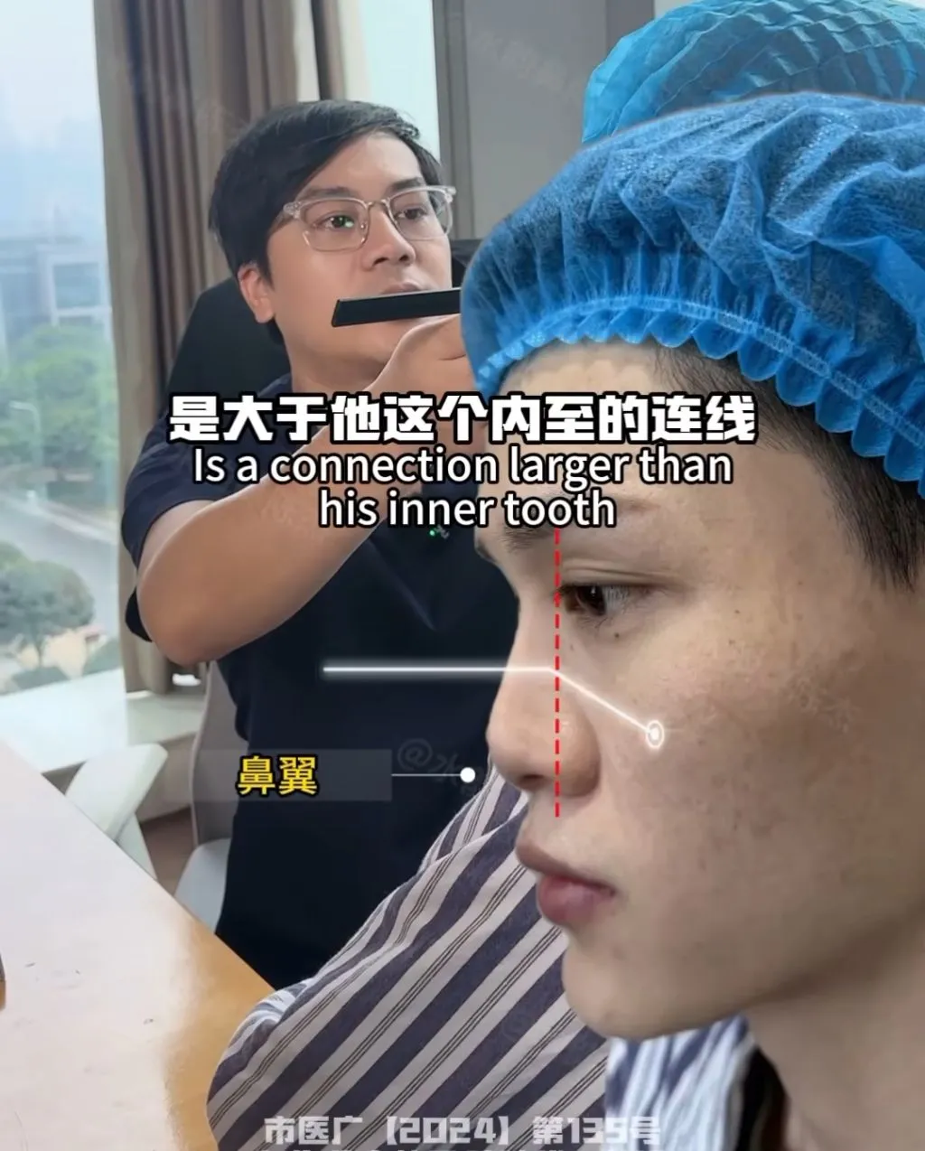 남자 코수술 레전드.jpg
