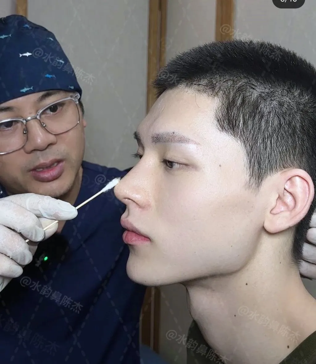 남자 코수술 레전드.jpg