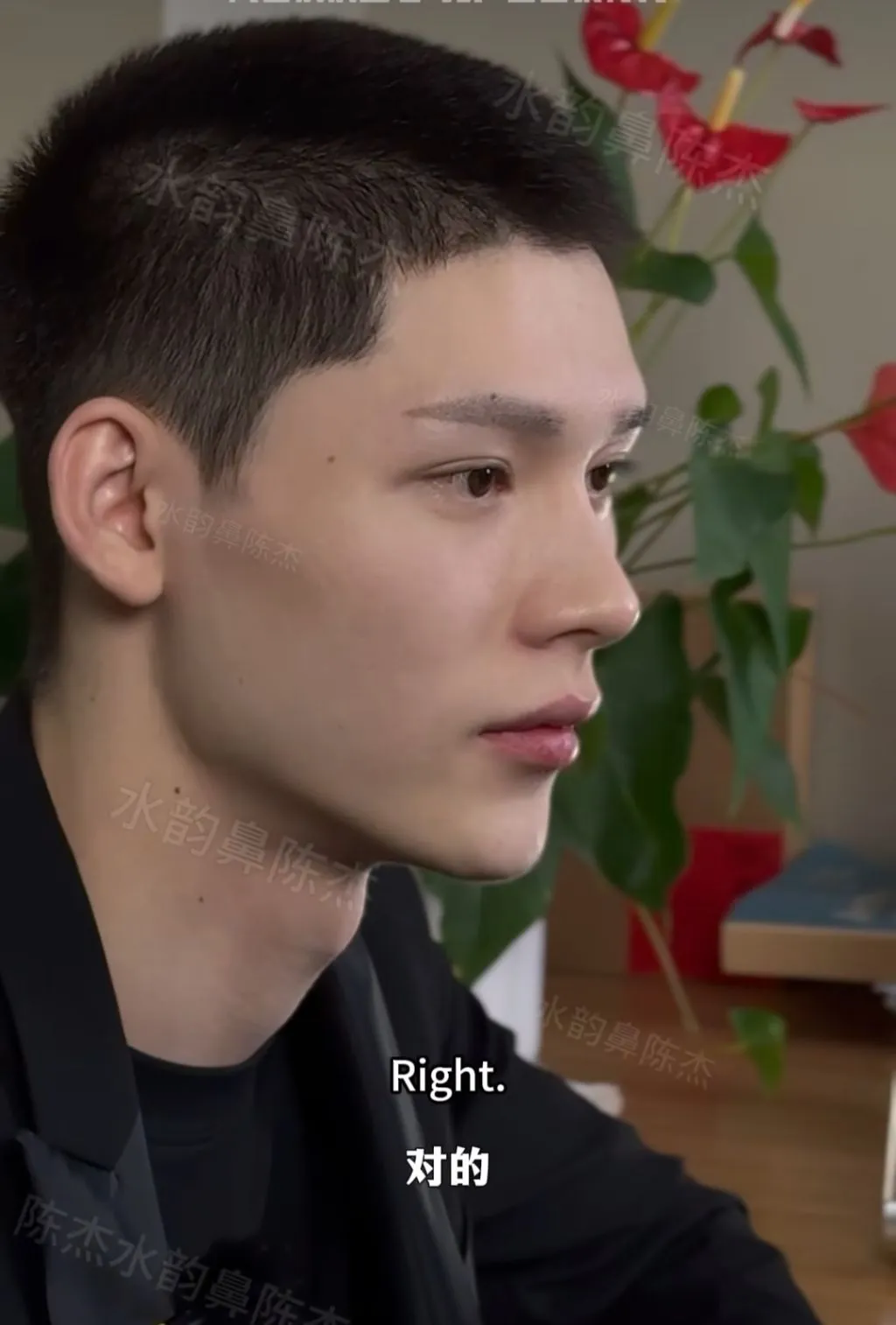 남자 코수술 레전드.jpg