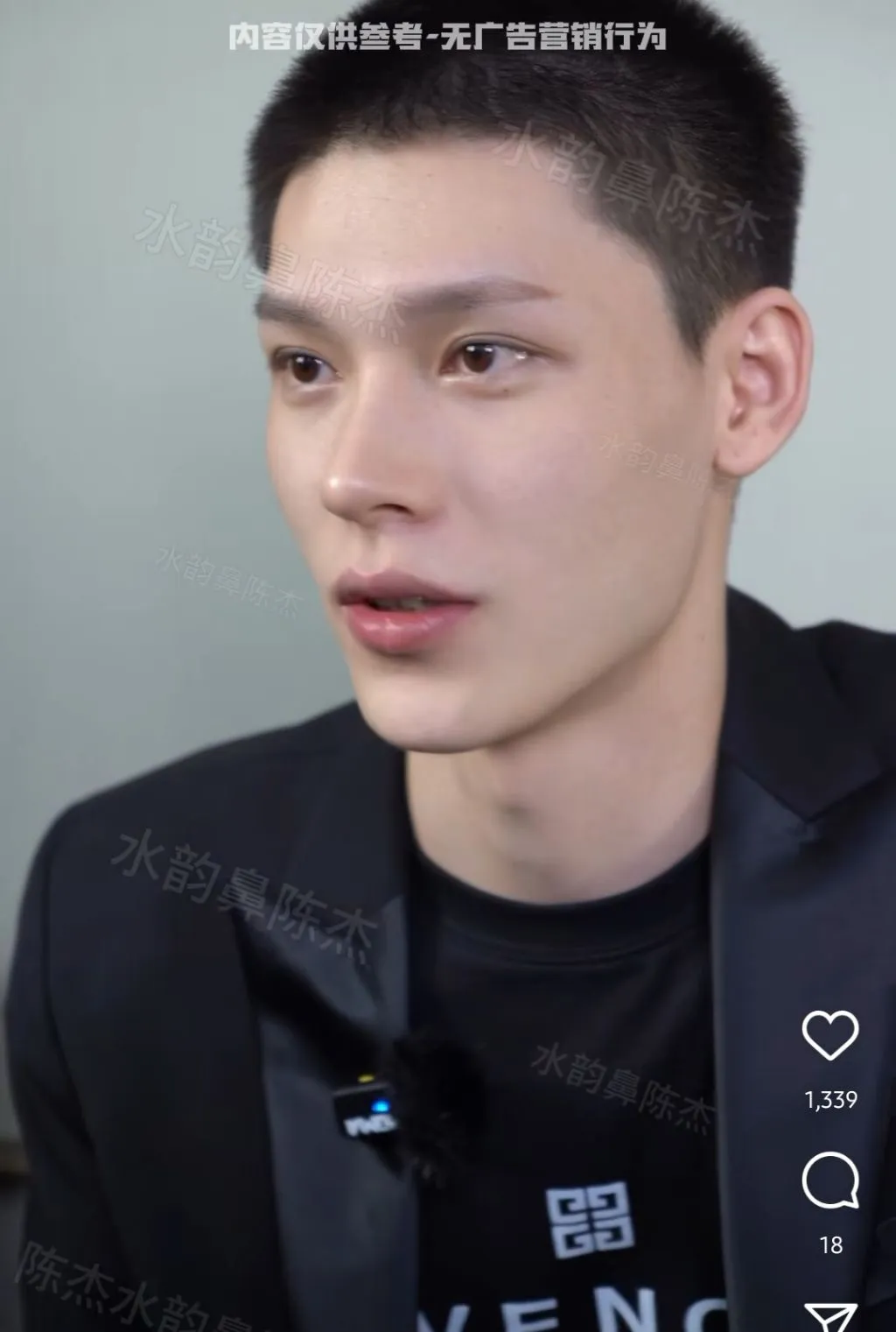 남자 코수술 레전드.jpg