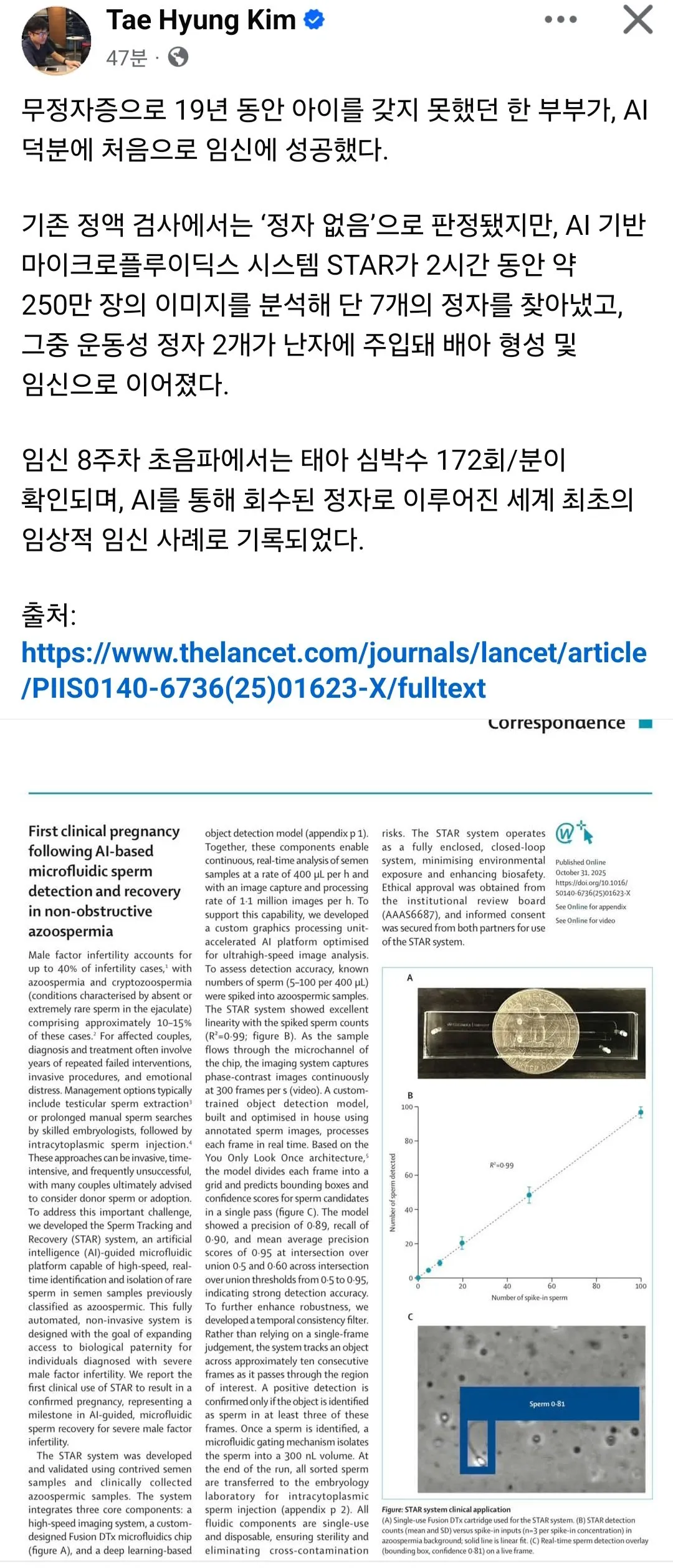 무정자증으로 19년동안 임신 못 하던 부부가 AI🤖의 도움으로 임신에 성공했다