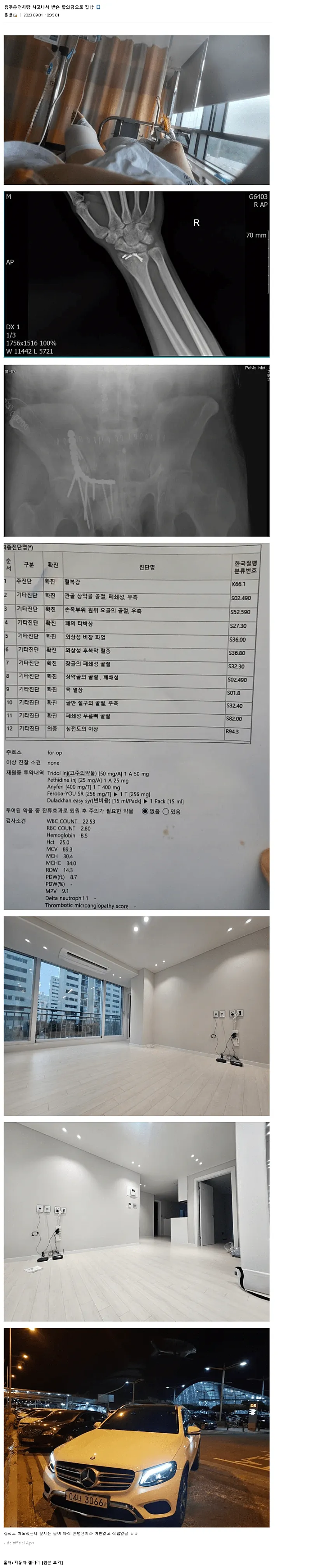 합의금으로 집, 벤츠 구매한 디씨인