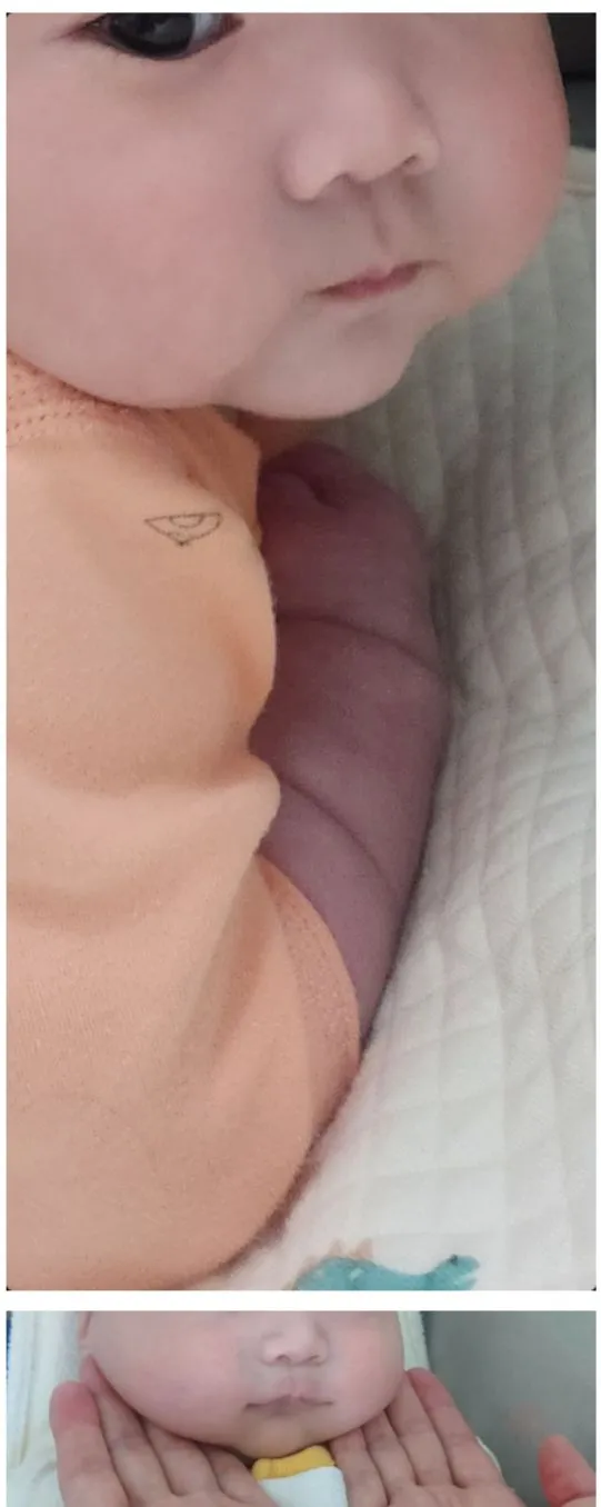 통통한 애기들 볼살