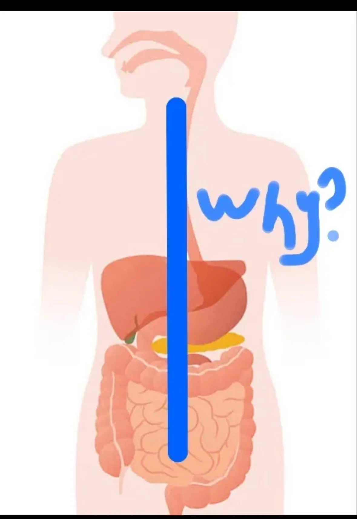 외국 why 밈 ㅋㅋ