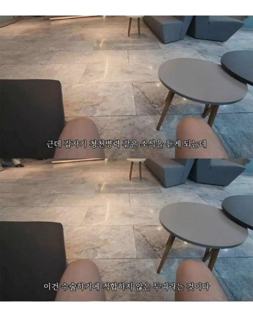 터키로 모발이식 받으러간 남성