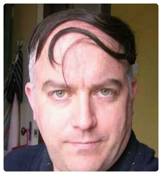 대머리를 가리는법!