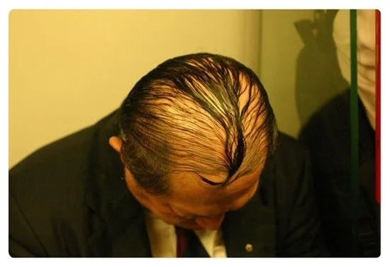 대머리를 가리는법!