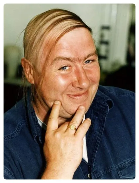 대머리를 가리는법!