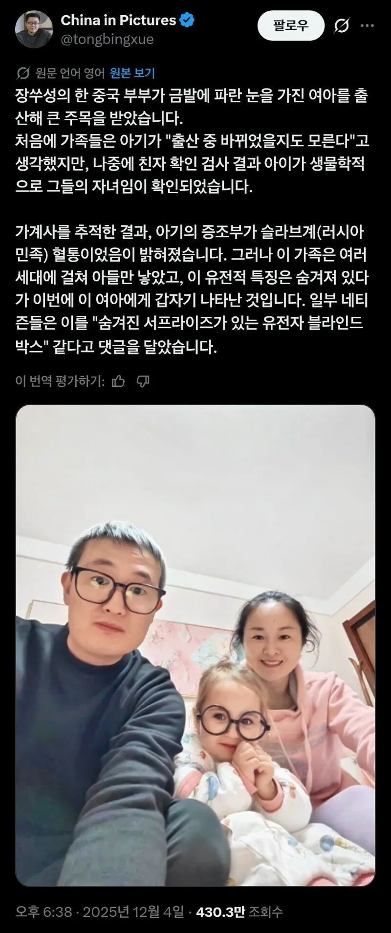 금발벽안 아이를 낳은 중국인 부부