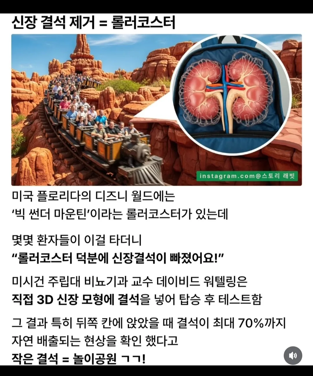 신장결석 제거하는방법.jpg