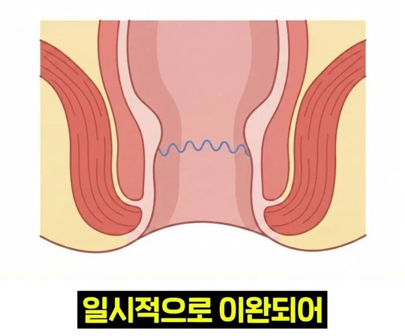 우리 뇌가 방귀와 똥을 구분하는 방법