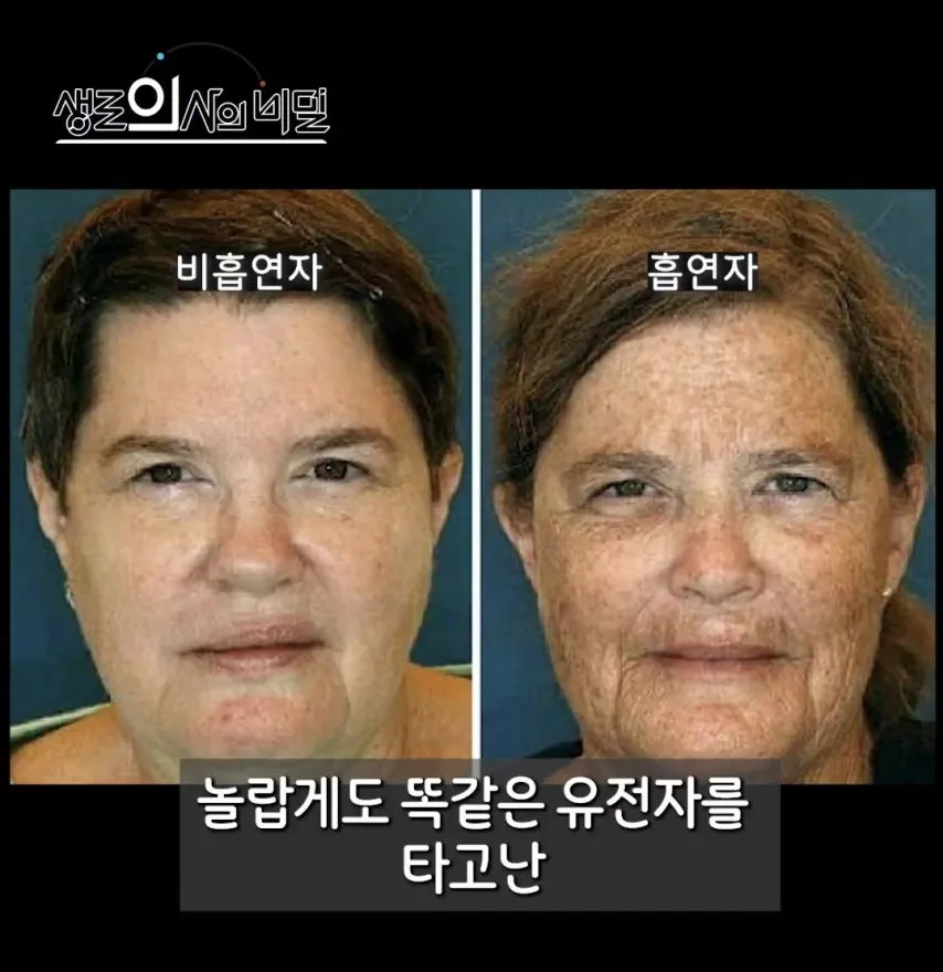 흡연이 피부에 미치는 영향.jpg